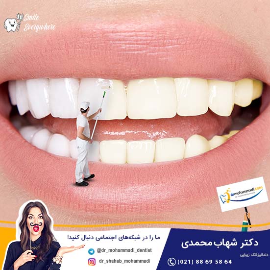 سیگار کشیدن بعد از کامپوزیت!؟ تاثیر دارد یا خیر؟ - کلینیک دندانپزشکی دکتر شهاب محمدی